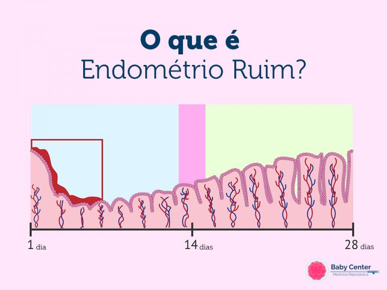 Como a espessura do endométrio pode afetar a gravidez? - Baby Center
