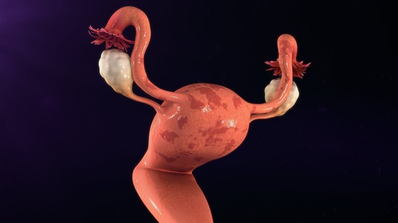Cirurgia Reprodutiva - Fertilivitá Reprodução Humana
